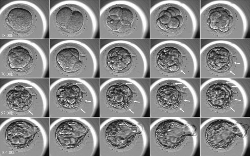 胚胎缩时摄影  TIMELAPSE
